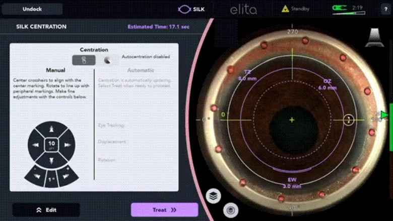 ELITA SILK centration screen: live view of the docked eye with treatment zones and manual alignment controls