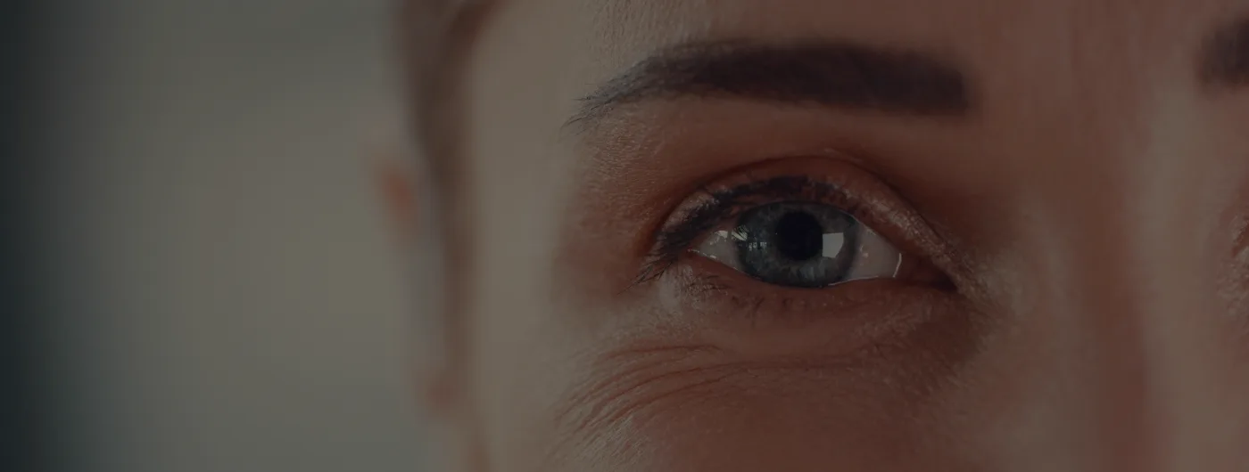 Close-up of a patient's eye before laser vision correction