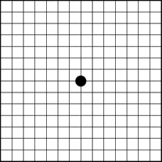 Amsler grid as seen with a healthy macula: straight, even lines