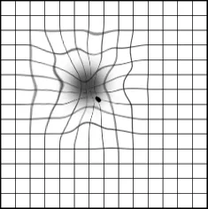 Amsler grid as seen with macular disease: wavy, distorted lines around a dark spot