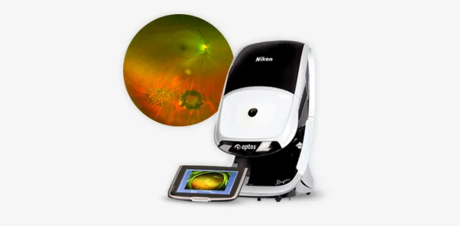 Daytona Optos non-mydriatic ultra-widefield fundus camera